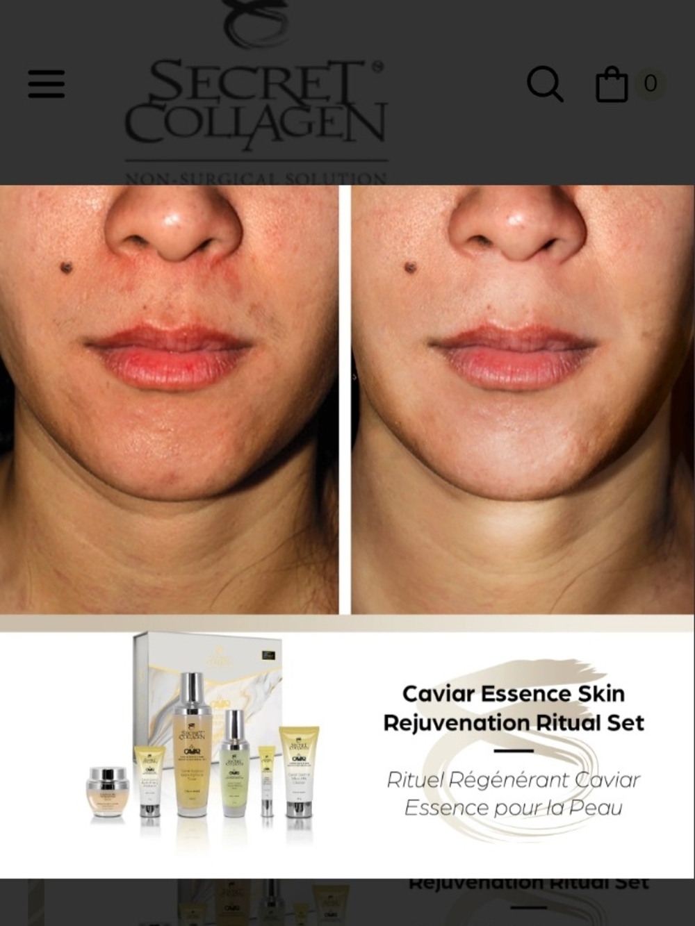 Caviar Essence Skin Rejuvenation Set - Yellow - Picture 3 of 10